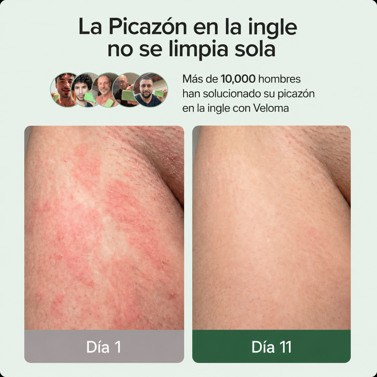 Jabón antigunfico Velora